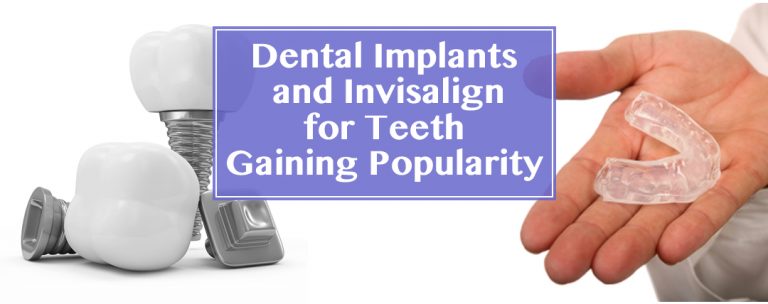 Dental Implants and Invisalign on Teeth Gaining Popularity in Las Vegas