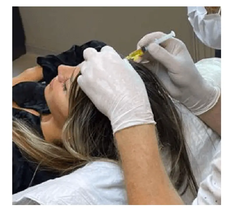 mesotherapy in Istanbul